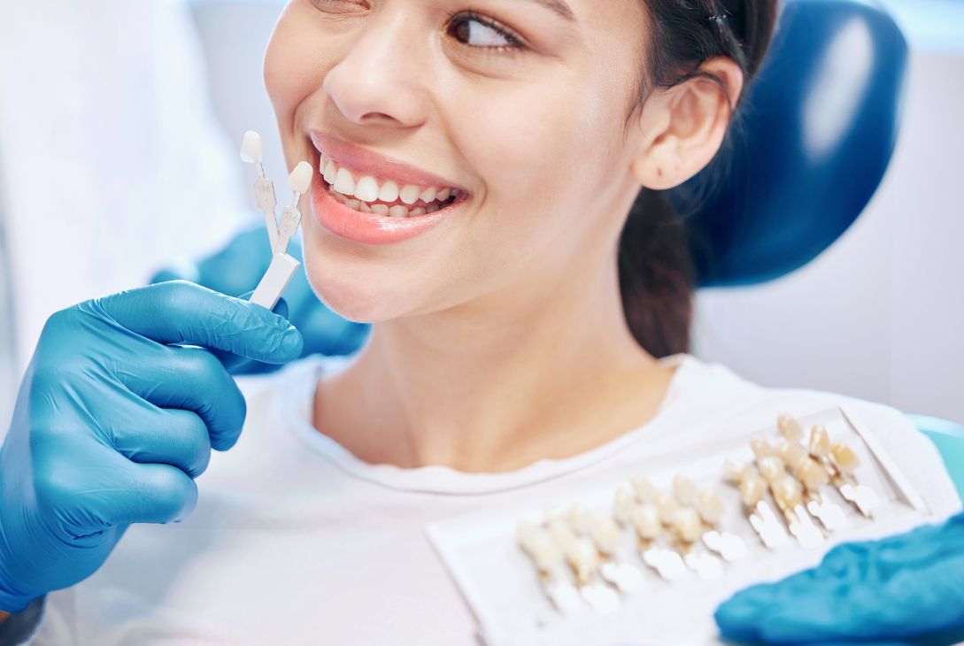 Opalescence Teeth Whitening