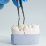 CEREC Crowns