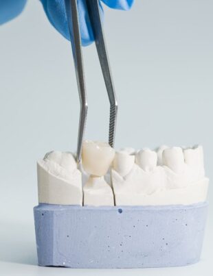 CEREC Crowns