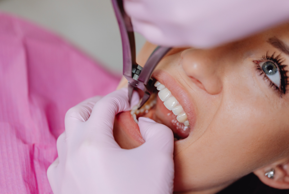 Periodontal Treatments for Advanced Problems