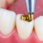 Restorative Dentistry