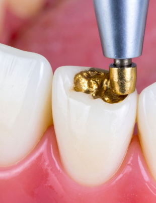 Restorative Dentistry