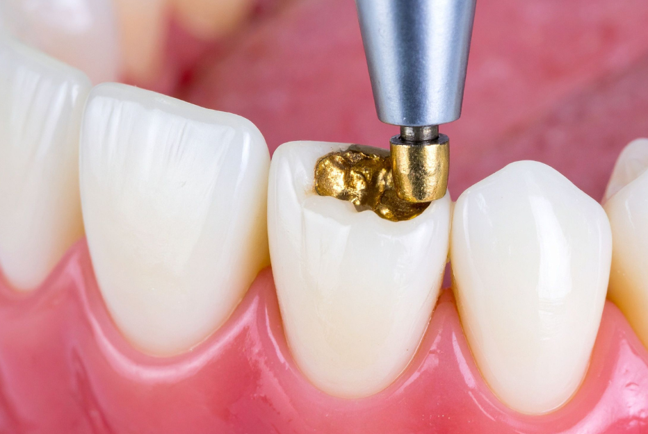 Restorative Dentistry