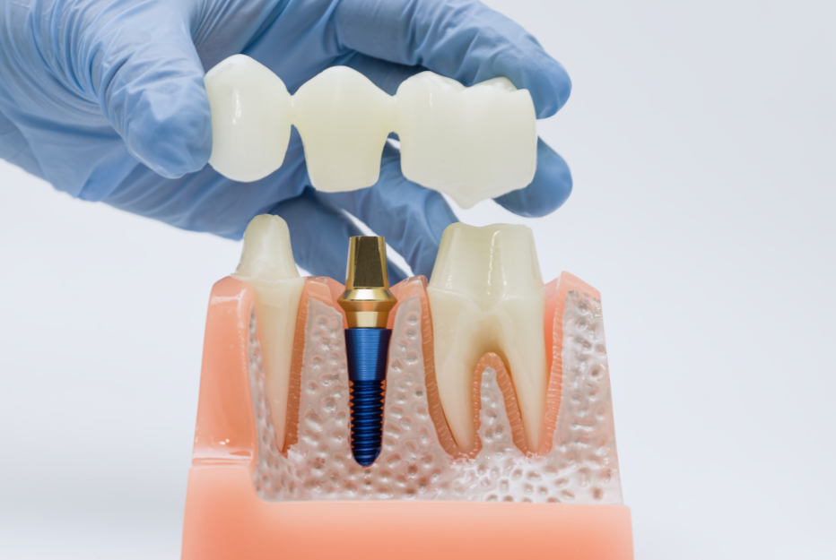 What is Restorative Dentistry