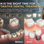 When Is the Right Time to Consider Restorative Dental Treatment?