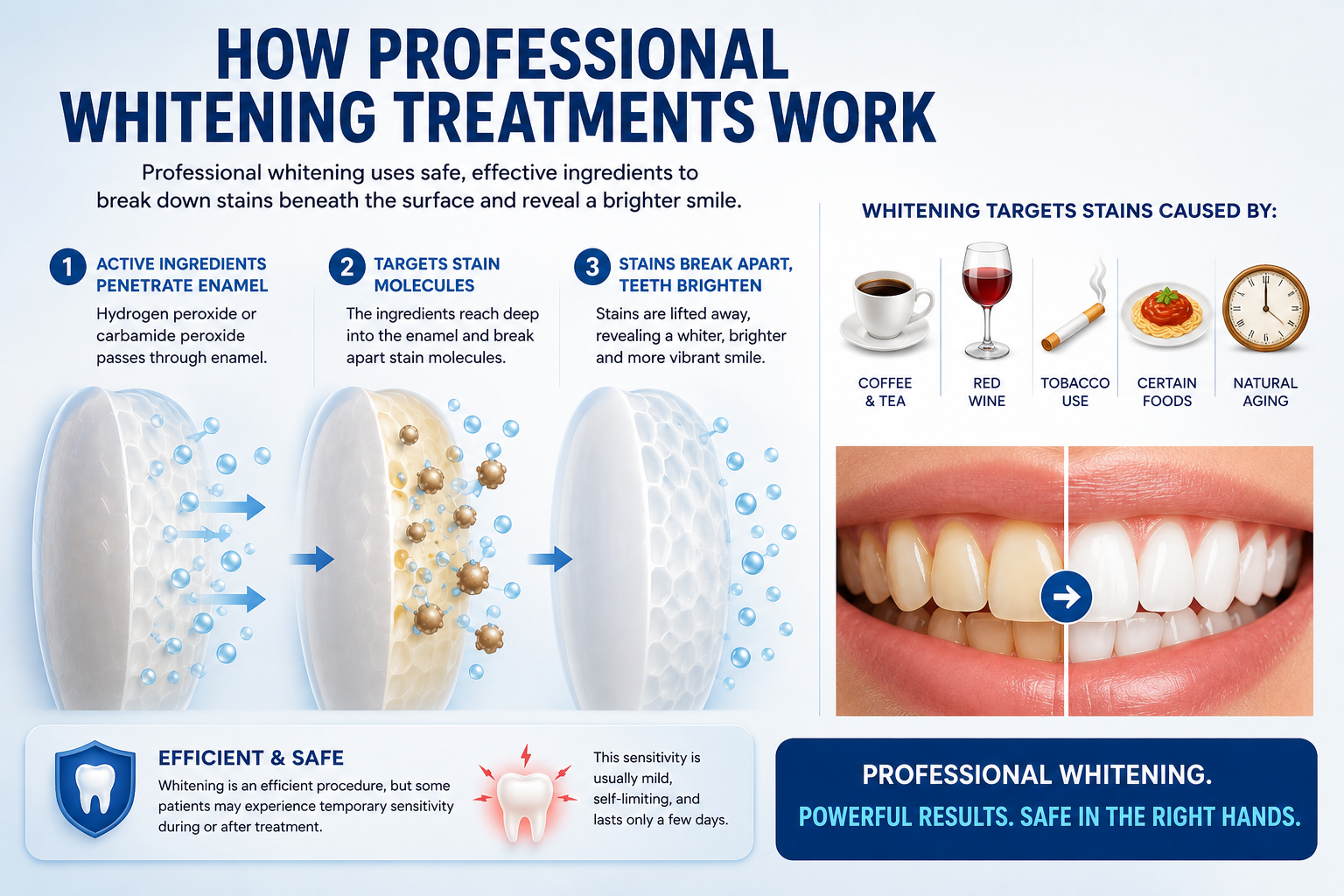 How professional whitening treatments work