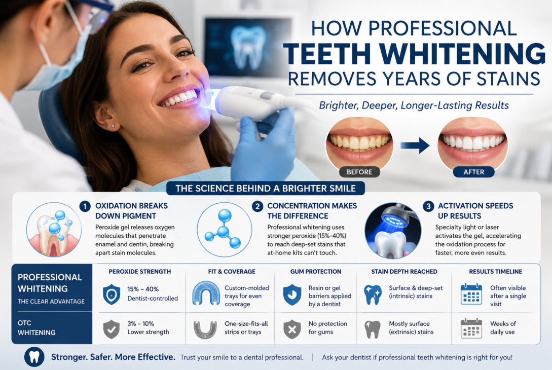 Professional teeth whitening benefits explained