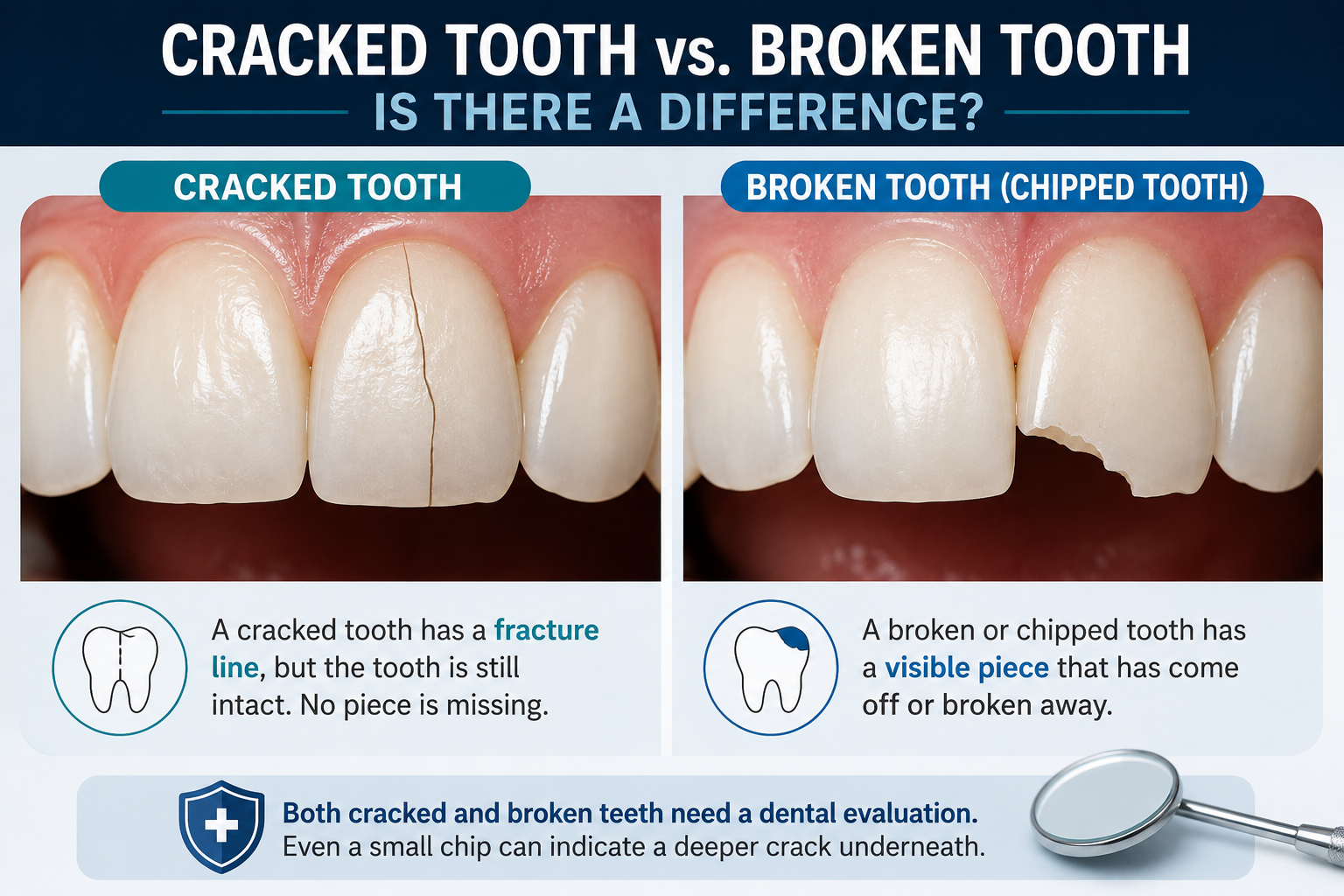 Cracked Tooth vs. Broken Tooth