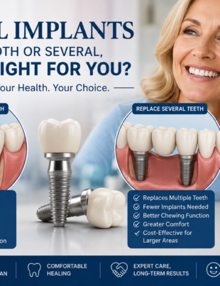 Dental Implants: Your Smile, Your Choice